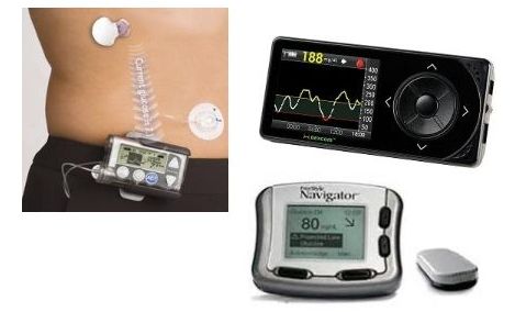 Figure 11. Examples of real-time continuous glucose monitoring systems.
