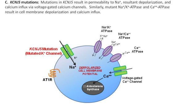 C. KCNJ5 mutations: Mutations in KCNJ5 result in permeability to Na+, resultant depolarization, and calcium influx via voltage-gated calcium channels. Similarly, mutant Na+/K+-ATPase and Ca++-ATPase result in cell membrane depolarization and calcium influx.