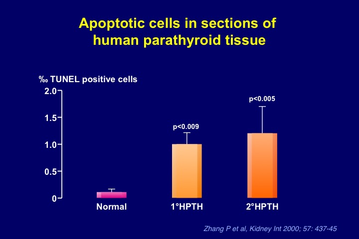 Figure 14. Increase in apoptotic parathyroid cells in glands removed from patients with primary or secondary uremic hyperparathyroidism, as compared to normal parathyroid tissue.