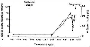 Figure 10. Sperm concentration and motility in a man with severe oligospermia and severe hypospermatogenesis included in a therapeutic trial of clomiphene. Semen quality improved and his wife conceived. He was given the placebo! (Baker HWG: Requirements for controlled therapeutic trials in male infertility. Clin Reprod Fertil 4:13-25, 1986.)