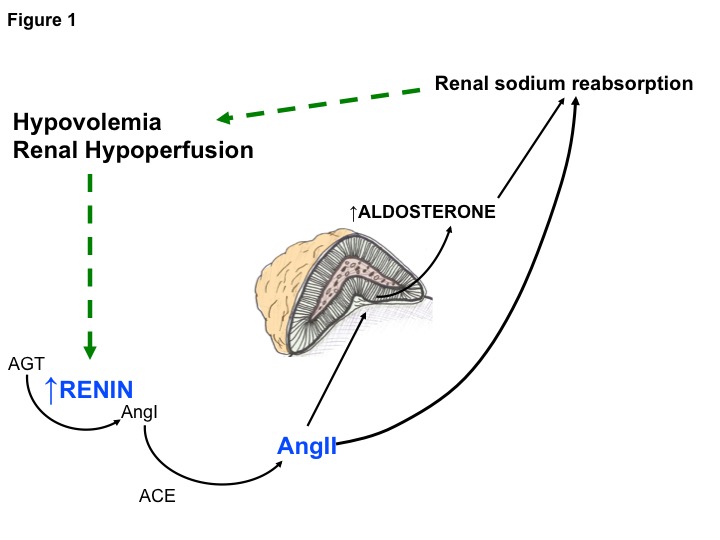 Figure 1: Renin-Dependent Aldosteronism. The physiologic relationship between the renin-angiotensin system and aldosterone regulation is referred to as “Renin-Dependent Aldosteronism,” also referred to as “Secondary Aldosteronism.” Decreased renal-vascular perfusion resulting in decreased glomerular filtration is sensed by juxtaglomerular cells. The consequent release of renin activates the renin-angiotensin system resulting in the synthesis of angiotensin II (AngII). AngII induces systemic vasoconstriction, increases proximal tubular sodium reabsorption, and stimulates aldosterone secretion. The net effect is increased renal sodium reabsorption and intravascular volume expansion which closes the feedback loop and corrects the initial stimulus to raise renin.