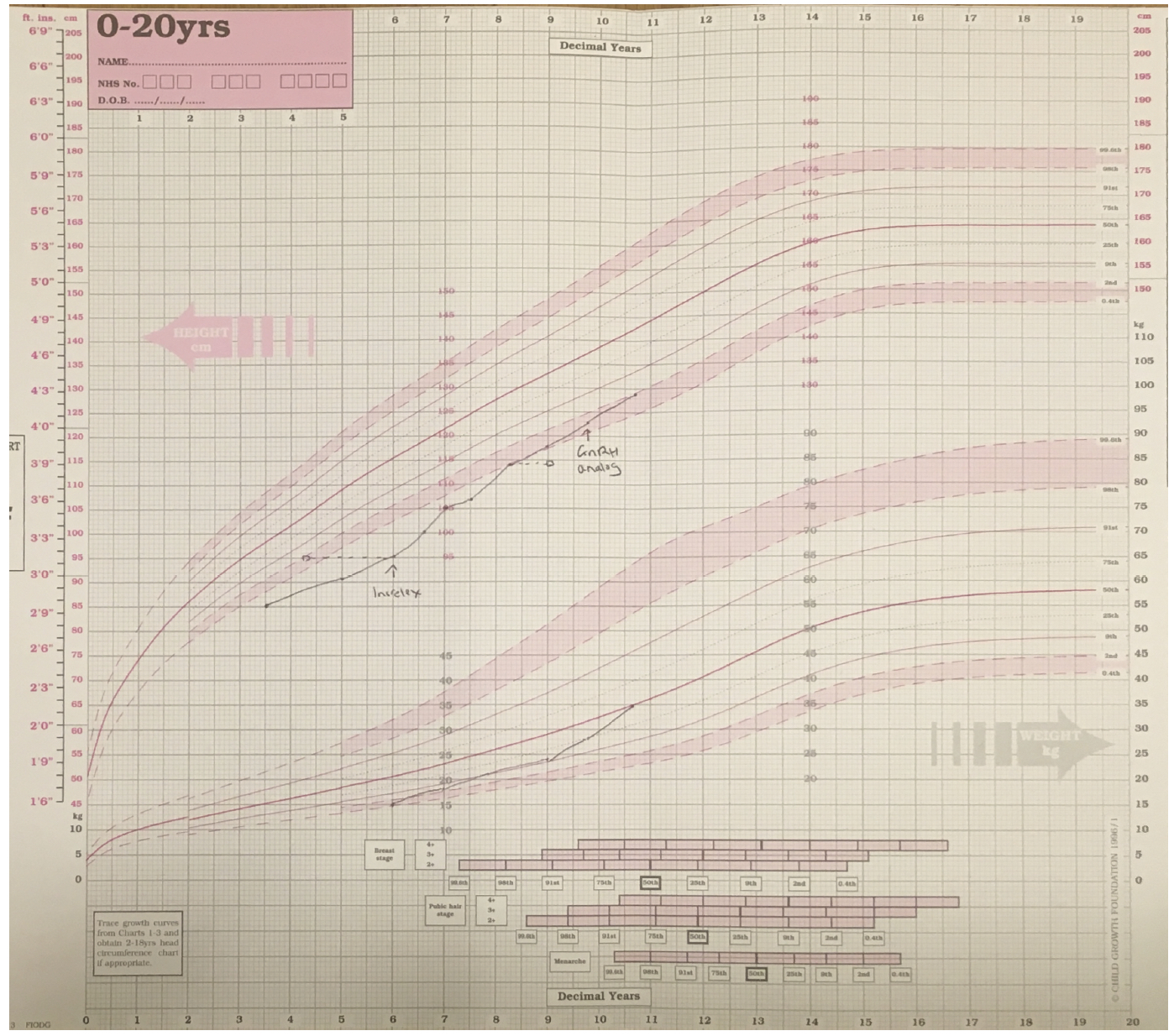 Figure 7 – Growth chart of girl with Laron syndrome treated with recombinant human IGF-I (Increlex) from age of 5.8 years when height SDS was -4.2 SD. There is an increase in height velocity over the first year of treatment which is reduced in subsequent years of therapy. Height SDS improves to -2.1 SD by 10.25 years but this has been associated with the onset of puberty at 9 years (treatment with the GnRH analog Zoladex was introduced at 9.8 years). Current height lies within parental target range. M denotes maternal height and F denotes adjusted paternal height.
