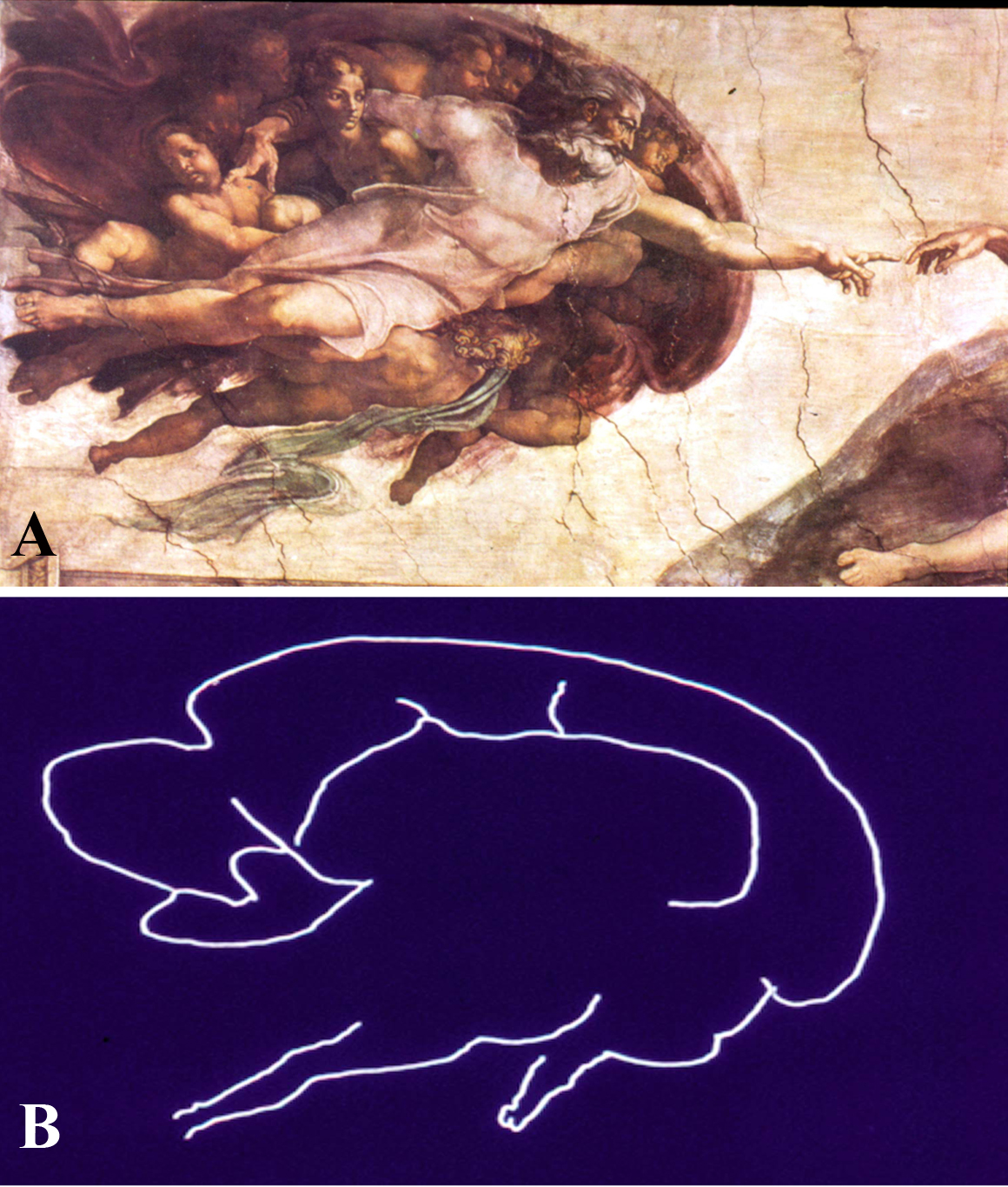 Fig. 4. Detail from the fresco, “Creation of Adam,” by Michelangelo Buonarroti, visible on the ceiling of the Sistine Chapel in the Vatican at Rome, Italy, painted between 1508-1512. (A) Photograph of the fresco showing God giving spiritual life and intellect to Adam through his touch; (B) The contour of the same image is reminiscent of a midline saggital section of the brain and includes the hypothalamus, pituitary and brainstem. (From Toni R, Malaguti A, Benfenati F, Martini L: The human hypothalamus: a morphofunctional perspective. J Endocrinol Invest 27 (supp to n.6), 73-94, 2004.)