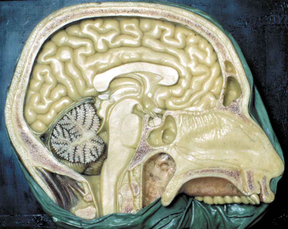 Fig. 11. Midsaggital section of the human brain (from the XIX century wax collection of human brains at the Museum of the Department of Human Anatomy of the Unversity of Bologna, Italy). The hypothalamus (asterisk) lies above the pituitary gland (cross) and has as its boundaries (1) the anterior commissure and lamina terminalis anteriorly; (2) mammillary bodies and midbrain posteriorly, and (3) thalamus superiorly.(From Lechan R.M. and Toni R., Regulation of Pituitary Function, in Korenman S.G (Ed), Atlas of Clinical Endocrinology, Current Medicine, vol IV, 1-25, 2000).