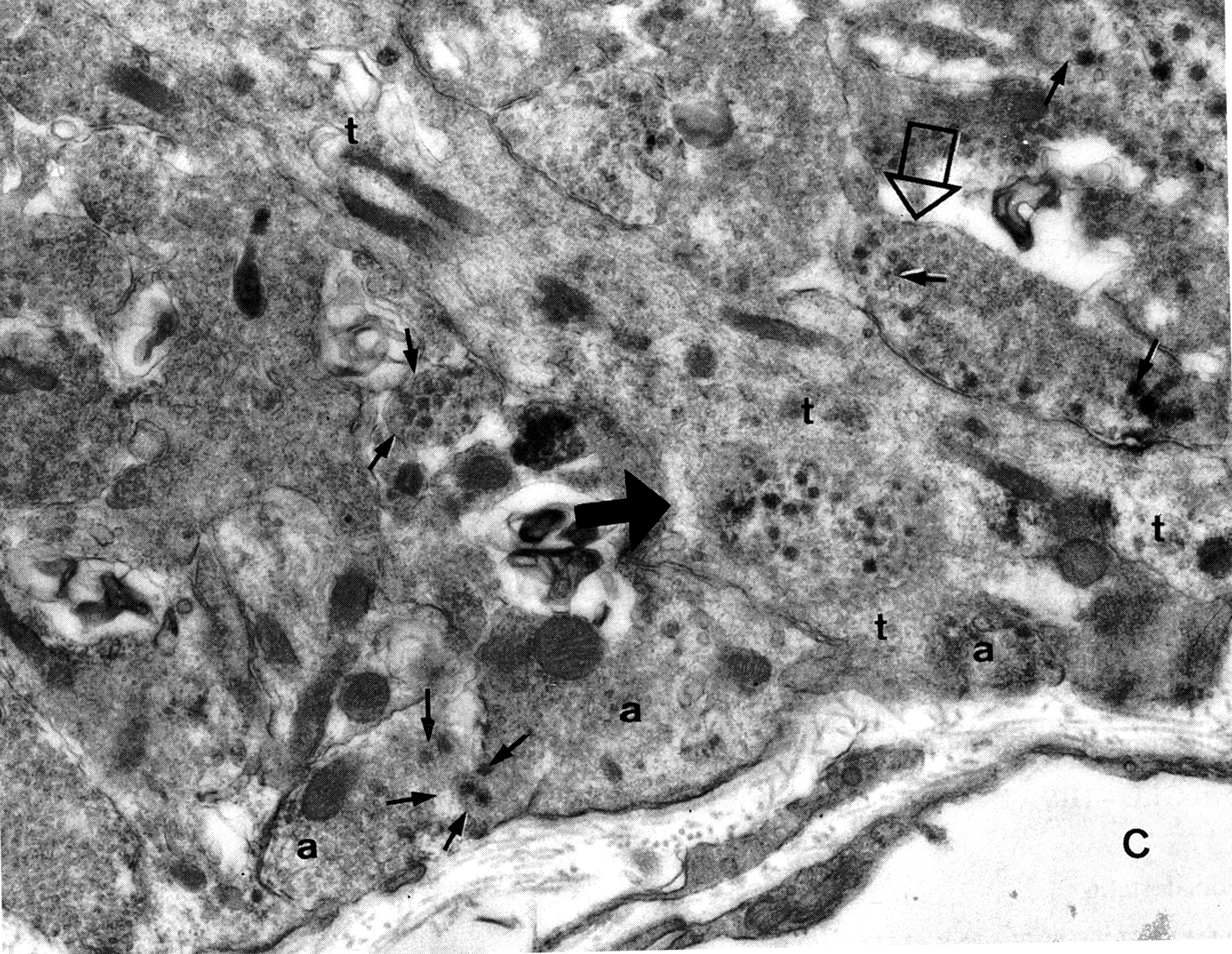 Fig. 21. Electron micrograph of the external zone of the median eminence showing the presence of axon terminals (a) and a tanycyte process (t) adjacent to a fenestrated capillary (C) of the portal plexus. One axon (closed arrowhead) has been engulfed by the tanycyte and another (open arrowhead) is separated from the portal capillary space by the tanycyte foot process. Note presence of dense core vesicles (arrows) as well as smaller secretory vesicles in several axon terminals. (From Lechan RM, Functional Microanatomy of the Hypophysial-Pituitary Axis, in Melmed, S (Ed), Oncogenesis and Molecular Biology of Pituitary Tumors, Frontiers of Hormone Research, 20: 2-40, 1996.)